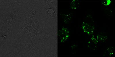 HUVEC cells