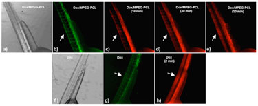 Zebrafish model: micelles slow the extravasation of Dox