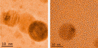 Spot the difference: electron-dense nodules on cell surface