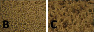 Morphological changes induced by exposure and laser treatment