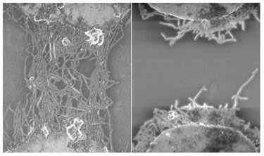 Deposition patterns