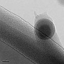 Catalyst particle