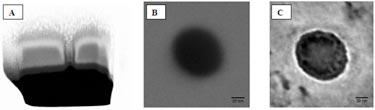 DNA-functionalized solid-state nanopore for biosensing