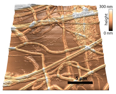 Big picture: AFM image of collagen fibrils