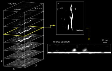 Nanoscale MRI images of tobacco mosaic virus particles