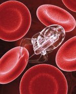 Nano-louse