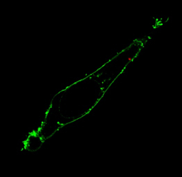 Hela cell with quantum dot