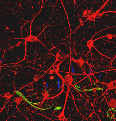 Sensors and neurons in the same tissue