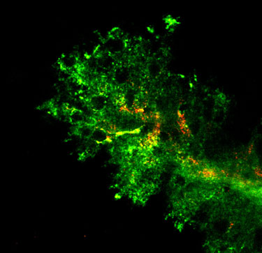 Real-time imaging of nanoparticles