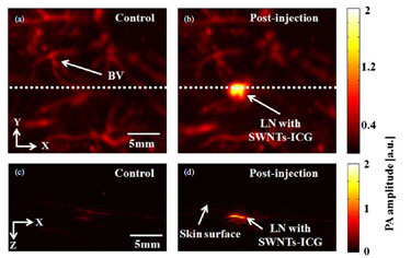 <i>In vivo</i> photoacoustic mapping of sentinel lymph nodes in rats.