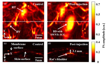 Photoacoustic mapping of bladders