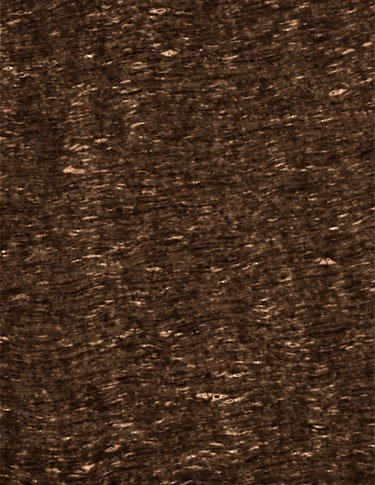 False-coloured SEM image