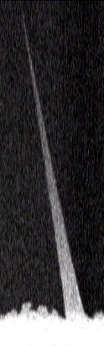 Nanopipette