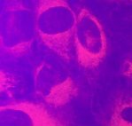 Treated cells