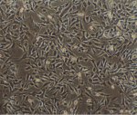 Cells on collagen