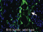 Tumour homing nanoparticle
