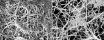 Laser cleaning