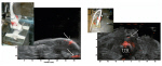 Ultrasound/photoacoustic images