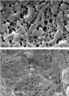 SWNT <i>versus</i> E. coli
