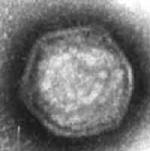 Typical iridovirus