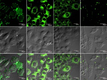 Cells incubated with carbon nanotubes
