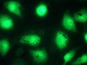 Fluorescence microscopy images of HeLa cells