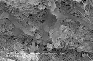 E. Coli cells retained on the group's SWNT filter