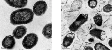 Antibacterial activity of graphene oxide nanosheets