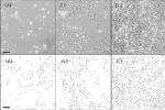 Fish cells on the move
