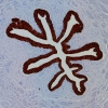 E. Coli