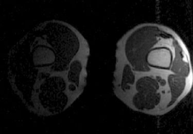 MRI Scans