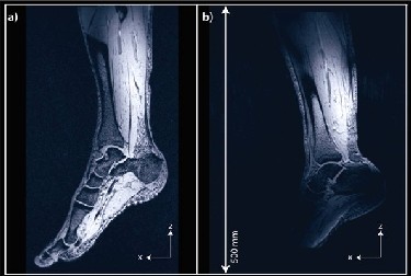MRI scan of human leg