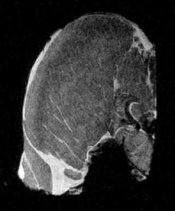 Pork chop scan