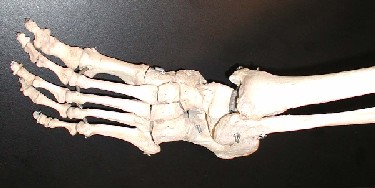 Raman spectroscopy sees inside bones