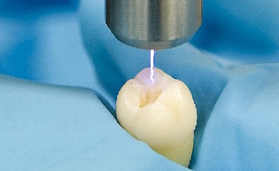 Tackling tooth decay