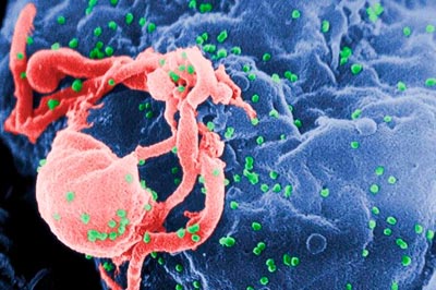 HIV-1 budding from a lymphocyte