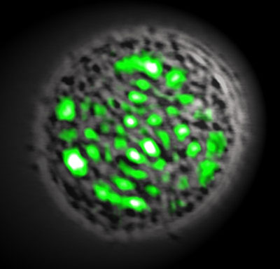 Microscope image of a living laser
