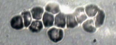 Image of red blood cells flowing in chains