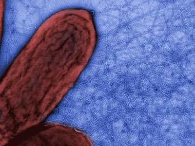 Transmission electron micrograph showing bacteria and nanowires