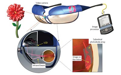 Diagram showing how the retinal implants work